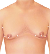 Gyne incision 1