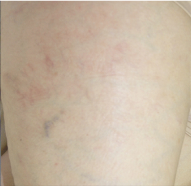 cyno veins_a