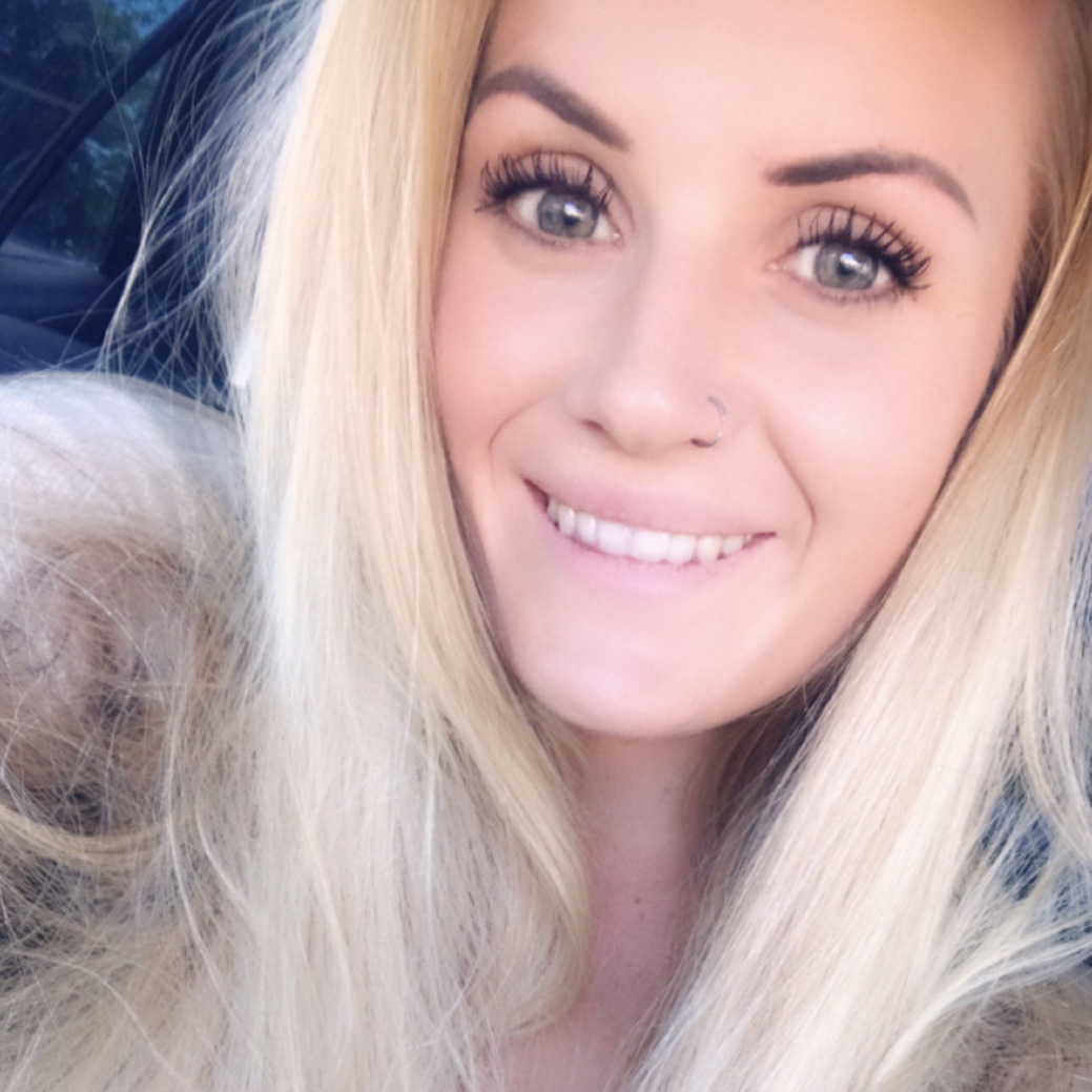 Michele G: Laser Hair Removal Recipient