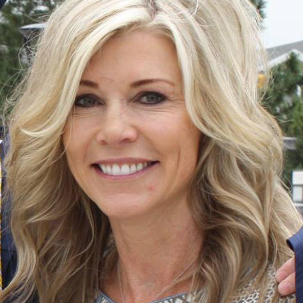 Sue M: Skin Tightening Package Recipient